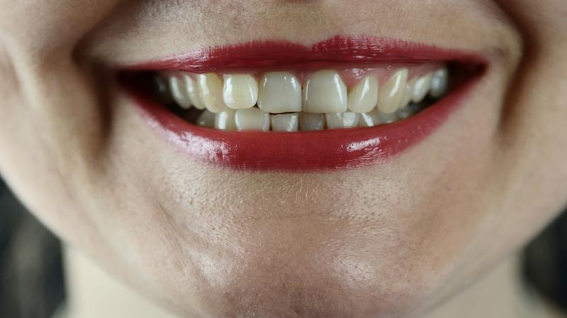 soñar con dientes